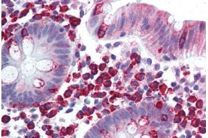 Colon, lamina propria plasma cells (LTK 抗体  (AA 800-864))