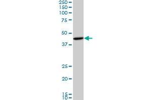 SMAD3 monoclonal antibody (M01A), clone 2C12. (SMAD3 抗体  (AA 120-221))
