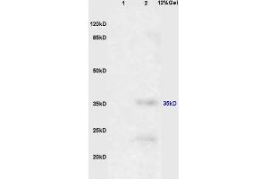 L1 mouse brain, L2 mouse liver lysates probed (ABIN670611) at 1:200 in 4 °C.