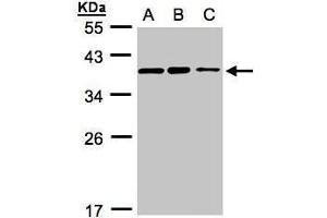 WB Image Sample(30 ug whole cell lysate) A:H1299 B:HeLa S3, C:Hep G2 , 12% SDS PAGE antibody diluted at 1:3000 (C9orf78 抗体)