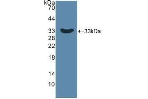 Detection of Recombinant DKK1, Human using Polyclonal Antibody to Dickkopf Related Protein 1 (DKK1) (DKK1 抗体  (AA 33-266))