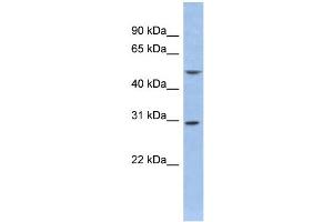 WB Suggested Anti-KCNIP2 Antibody Titration:  0. (KCNIP2 抗体  (Middle Region))