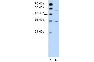 Western Blotting (WB) image for anti-G Protein-Coupled Receptor, Family C, Group 5, Member A (GPRC5A) (C-Term) antibody (ABIN635045)