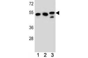 TUBB6 antibody western blot analysis in K562, HeLa, MDA-MB231 lysate. (TUBb6 抗体  (AA 139-166))