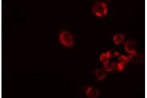 ABIN6278552 staining Hela cells by IF/ICC. (ARAF 抗体  (Internal Region))