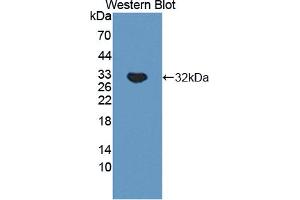 Western blot analysis of the recombinant protein. (TNXB 抗体  (AA 3824-4071))