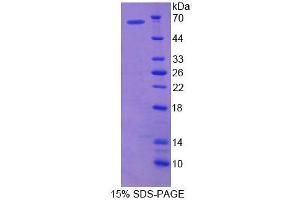 SDS-PAGE analysis of Mouse HRG Protein. (HRG 蛋白)