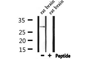 Western blot analysis of extracts from rat brain, using Ribosomal Protein S2 Antibody. (RPS2 抗体  (C-Term))