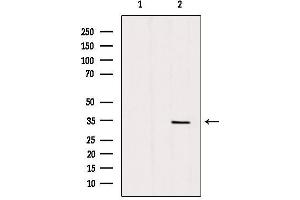 Western Blotting (WB) image for anti-Solute Carrier Family 25 (Mitochondrial Carrier, Adenine Nucleotide Translocator), Member 5 (SLC25A5) (Internal Region) antibody (ABIN6265122)