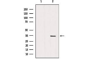 Western blot analysis of extracts from mouse brain, using SLC25A5 Antibody. (SLC25A5 抗体  (Internal Region))