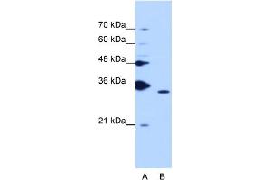 WB Suggested Anti-PPIE Antibody Titration:  1. (PPIE 抗体  (Middle Region))