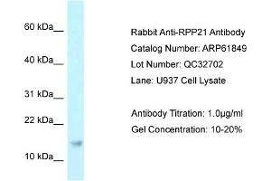 Western Blotting (WB) image for anti-Ribonuclease P/MRP 21kDa Subunit (RPP21) (Middle Region) antibody (ABIN2788924) (RPP21 抗体  (Middle Region))