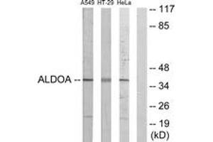 Western blot analysis of extracts from A549/HeLa/HT-29 cells, using ALDOA Antibody. (ALDOA 抗体  (AA 1-50))