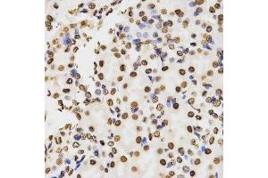 Immunohistochemistry of paraffin-embedded mouse kidney tissue using H3K9me2 antibody at dilution of 1:200 (x400 lens). (Histone 3 抗体  (H3K9me2))