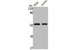Western Blotting (WB) image for anti-Solute Carrier Family 2 (Facilitated Glucose Transporter), Member 1 (SLC2A1) (C-Term) antibody (ABIN7184959)