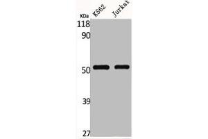 Western Blot analysis of K562 Jurkat cells using Glut1 Polyclonal Antibody (GLUT1 抗体  (C-Term))