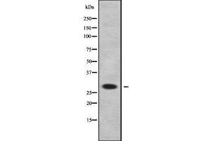 Western blot analysis of DHRS11 using Jurkat whole cell lysates (DHRS11 抗体  (Internal Region))
