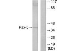 Western blot analysis of extracts from 293 cells, using Pax-5 Antibody. (PAX5 抗体  (AA 1-50))