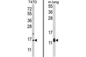 (LEFT) Western blot analysis of PEA-15 Antibody (C-term) in T47D cell line lysates (35ug/lane). (PEA15 抗体  (C-Term))