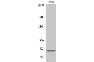 Western Blotting (WB) image for anti-Mitochondrially Encoded NADH Dehydrogenase 5 (MT-ND5) (Internal Region) antibody (ABIN3185786) (MT-ND5 抗体  (Internal Region))