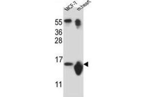 Western Blotting (WB) image for anti-Small Nuclear Ribonucleoprotein D3 Polypeptide 18kDa (SNRPD3) antibody (ABIN2912095) (SNRPD3 抗体)