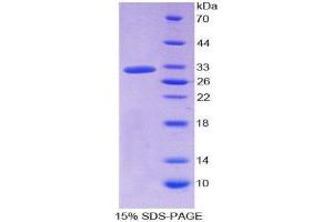 SDS-PAGE (SDS) image for Haptoglobin Related Protein (HPR) (AA 102-347) protein (His tag) (ABIN1099135)