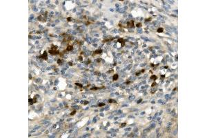 IHC analysis of GFI1 using anti-GFI1 antibody (ABIN7599380). (GFI1 抗体  (AA 1-422))