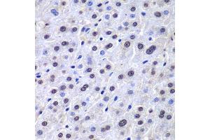 Immunohistochemistry of paraffin-embedded human liver injury using APEX1 antibody. (APEX1 抗体  (AA 1-318))