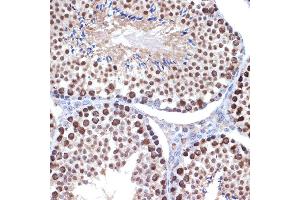 Immunohistochemistry (IHC) image for anti-High Mobility Group Box 2 (HMGB2) antibody (ABIN7267649)