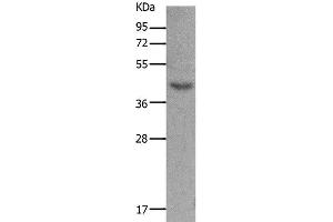 Western Blot analysis of Mouse muscle tissue using MC5R Polyclonal Antibody at dilution of 1:1200 (MC5 Receptor 抗体)