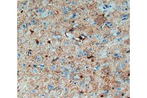 IHC-P analysis of brain tissue, with DAB staining. (S100B 抗体  (AA 1-92))