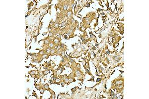 Immunohistochemistry (IHC) image for anti-Carcinoembryonic Antigen-Related Cell Adhesion Molecule 5 (CEACAM5) antibody (ABIN7266084)