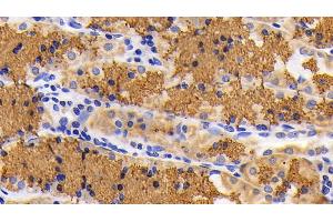 Detection of CYCS in Human Stomach Tissue using Polyclonal Antibody to Cytochrome C (CYCS)