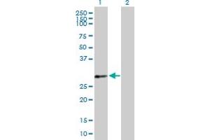 Western Blot analysis of PDLIM4 expression in transfected 293T cell line by PDLIM4 MaxPab polyclonal antibody. (PDLIM4 抗体  (AA 1-246))