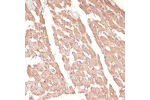 Immunohistochemistry of paraffin-embedded rat heart using A antibody (ABIN1678588, ABIN3015506, ABIN3015508 and ABIN6218562) at dilution of 1:100 (40x lens).