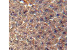 IHC-P analysis of Liver tissue, with DAB staining. (ITIH3 抗体  (AA 279-467))