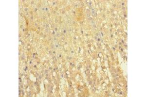 Immunohistochemistry of paraffin-embedded human adrenal gland tissue using ABIN7151346 at dilution of 1:100 (EML2 抗体  (AA 1-418))