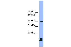 WB Suggested Anti-NFATC1 Antibody Titration: 0. (NFATC1 抗体  (N-Term))