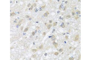 Immunohistochemistry of paraffin-embedded Rat brain using HARS2 Polyclonal Antibody at dilution of 1:100 (40x lens). (HARS2 抗体)
