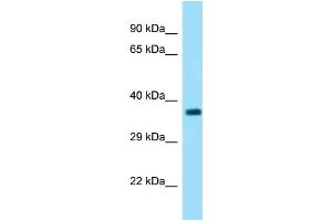 WB Suggested Anti-Fbxo2 Antibody   Titration: 1. (FBXO2 抗体  (C-Term))