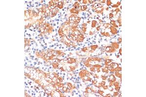 Immunohistochemistry of paraffin-embedded human stomach using HHL antibody (ABIN6132190, ABIN6141750, ABIN6141751 and ABIN6217197) at dilution of 1:100 (40x lens). (HHLA2 抗体  (AA 30-200))