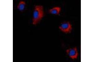 Immunofluorescent analysis of Claudin 2 staining in A431 cells. (Claudin 2 抗体  (C-Term))