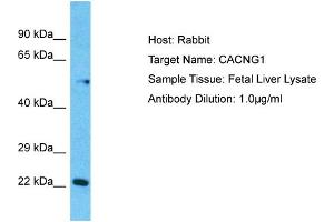 Host:  Rabbit  Target Name:  CACNG1  Sample Type:  Fetal Liver lysates  Antibody Dilution:  1. (CACNG1 抗体  (N-Term))