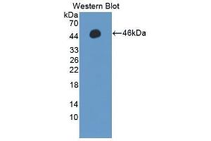 Western Blotting (WB) image for anti-Protein Phosphatase, Mg2+/Mn2+ Dependent, 1A (PPM1A) (AA 2-382) antibody (ABIN1869913) (PPM1A 抗体  (AA 2-382))