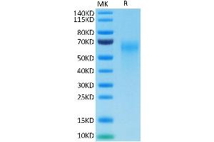 Cynomolgus IL-2 R gamma on Tris-Bis PAGE under reduced conditions. (IL2RG Protein (AA 23-254) (His tag))