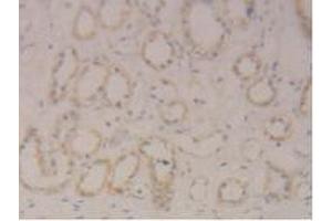 Immunohistochemistry (IHC) image for anti-Signal Transducer and Activator of Transcription 3 (Acute-Phase Response Factor) (STAT3) (AA 335-546) antibody (ABIN7444046)