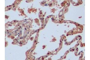 Immunohistochemistry (IHC) image for anti-Isocitrate Dehydrogenase 1 (NADP+), Soluble (IDH1) (AA 74-333) antibody (ABIN7436579)