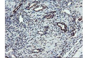 Image no. 13 for anti-TSC22 Domain Family, Member 1 (TSC22D1) antibody (ABIN1501540)
