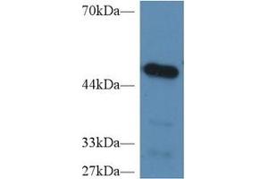 Detection of CPB2 in Mouse Heart lysate using Polyclonal Antibody to Carboxypeptidase B2 (CPB2) (CPB2 抗体  (AA 113-422))