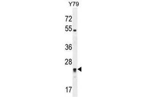 Western Blotting (WB) image for anti-Deleted in Primary Ciliary Dyskinesia Homolog (DPCD) (AA 99-140), (Middle Region) antibody (ABIN951973)